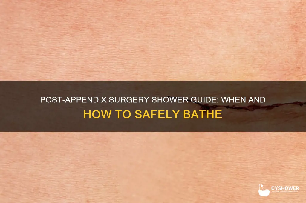 can you take a shower after appendix surgery