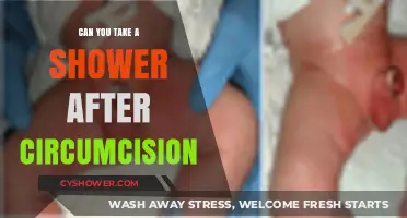 Post-Circumcision Shower Guide: When and How to Safely Cleanse