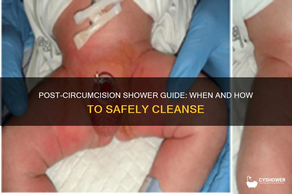 can you take a shower after circumcision