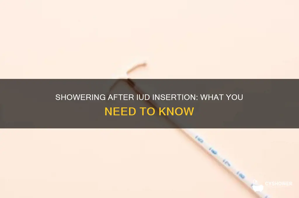 can you take a shower after getting an iud