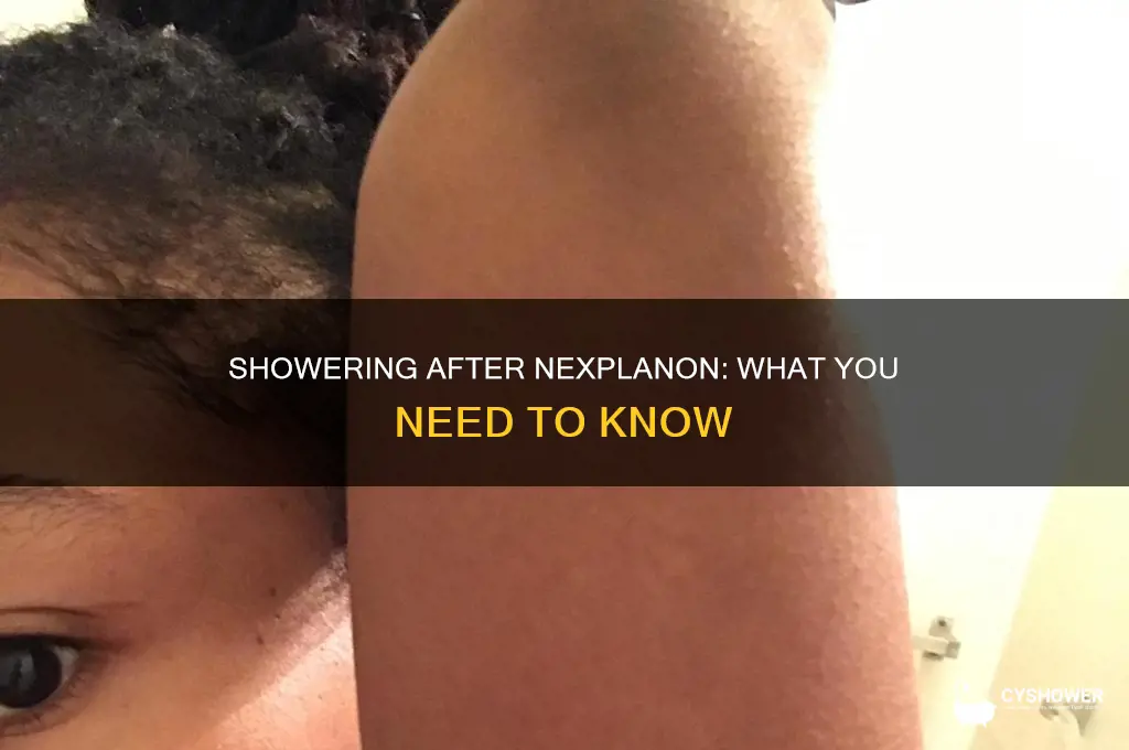 can you take a shower after getting nexplanon