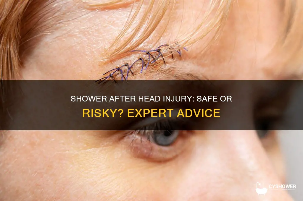 can you take a shower after hitting your head
