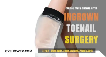 Post-Ingrown Toenail Surgery Shower Guide: When and How to Safely Cleanse