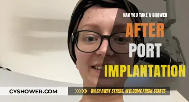 Showering Safely After Port Implantation: What You Need to Know