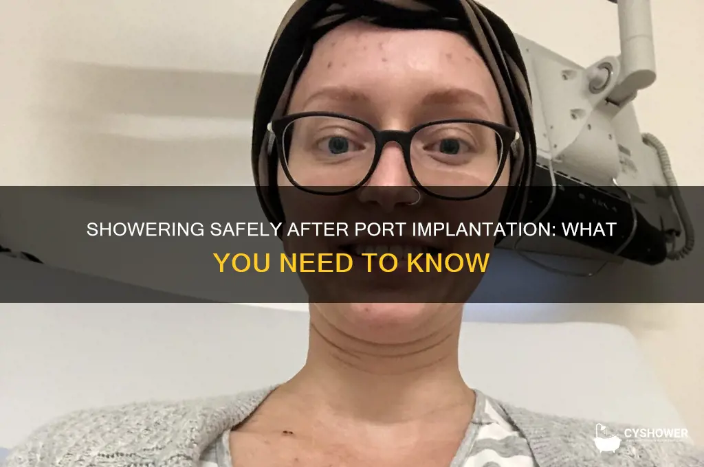 can you take a shower after port implantation