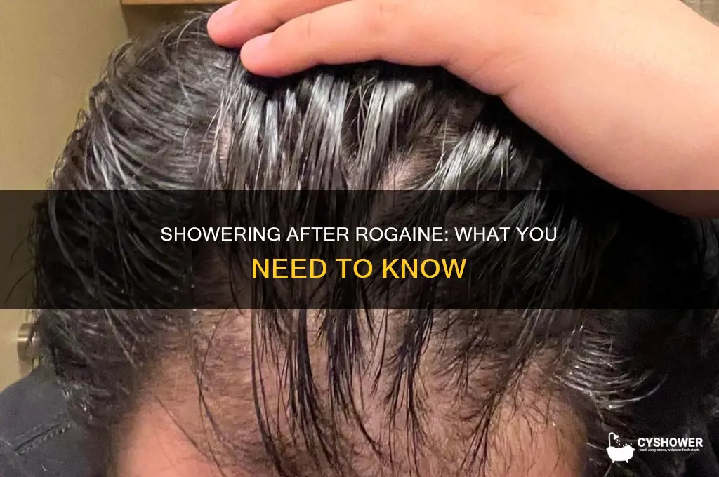 can you take a shower after rogaine