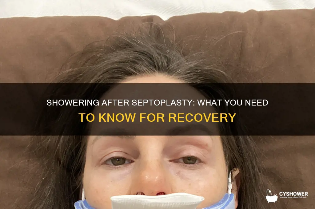 can you take a shower after septoplasty