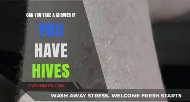 Showering with Hives: Safe Practices for Soothing Irritated Skin