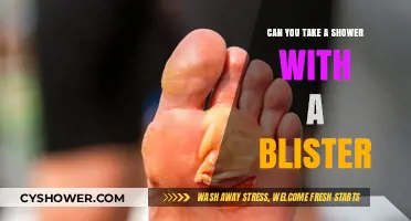 Showering with a Blister: Safe Practices and Healing Tips