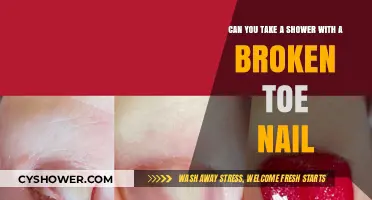 Showering with a Broken Toenail: Tips for Pain-Free Hygiene