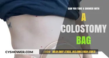 Showering with a Colostomy Bag: Tips for Comfort and Confidence