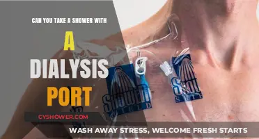 Showering Safely with a Dialysis Port: What You Need to Know