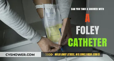 Showering Safely with a Foley Catheter: Tips and Precautions