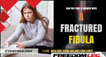 Showering with a Fractured Fibula: Tips for Safe and Comfortable Healing