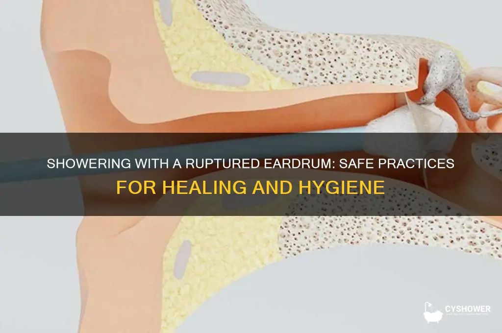 can you take a shower with a infected raptured eardrum