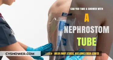 Showering with a Nephrostomy Tube: Tips for Safe Hygiene