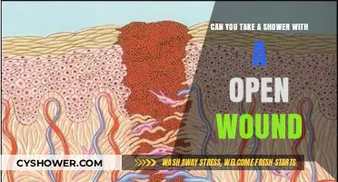 Showering with an Open Wound: Safe Practices and Precautions