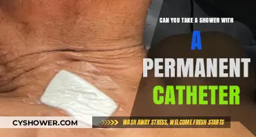 Showering Safely with a Permanent Catheter: Tips and Precautions