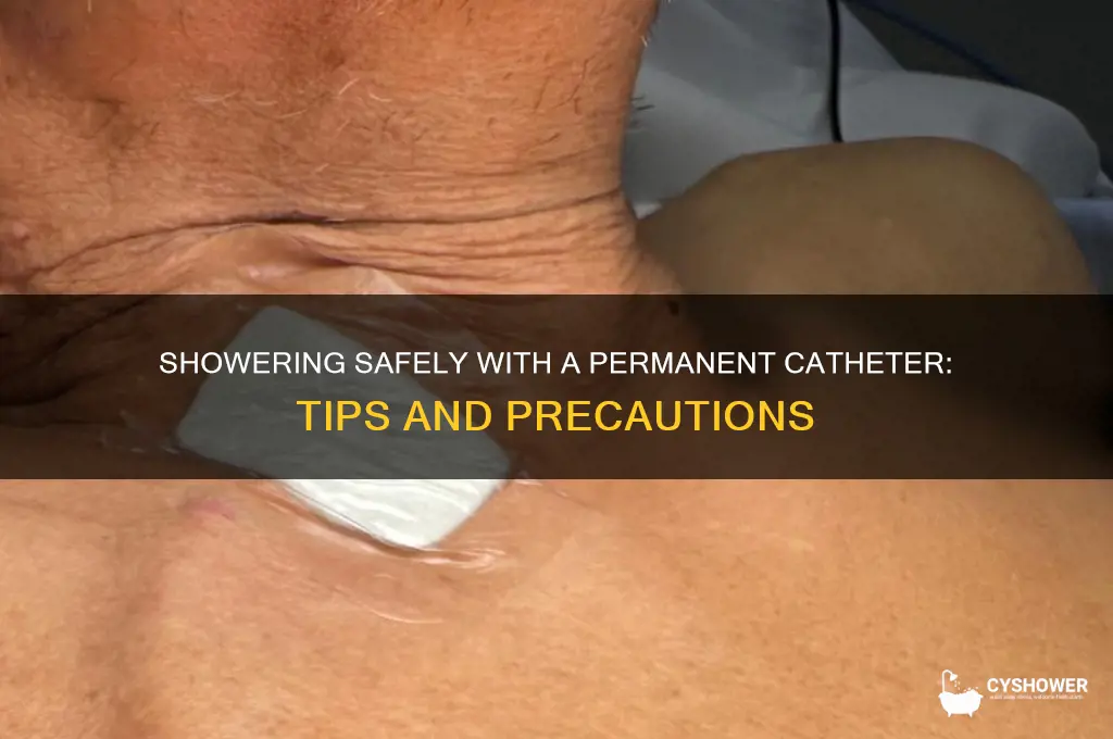 can you take a shower with a permanent catheter