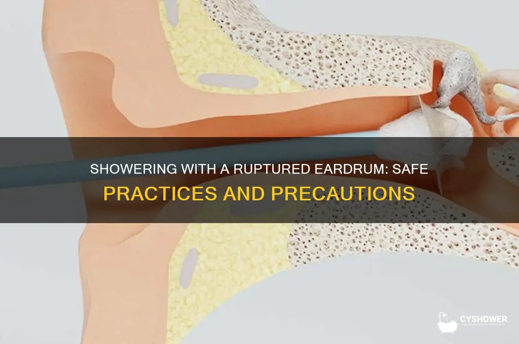 can you take a shower with a ruptured eardrum