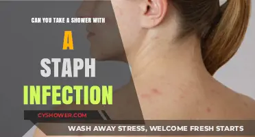 Showering with a Staph Infection: Safe Practices and Precautions