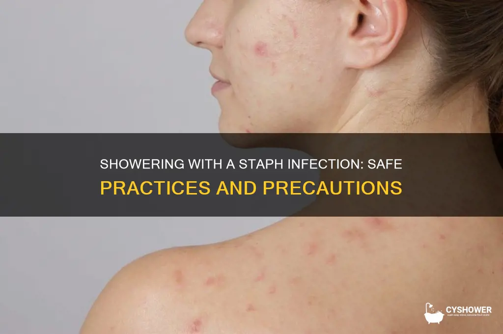 can you take a shower with a staph infection