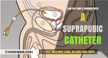Showering with a Suprapubic Catheter: Tips for Safe Hygiene