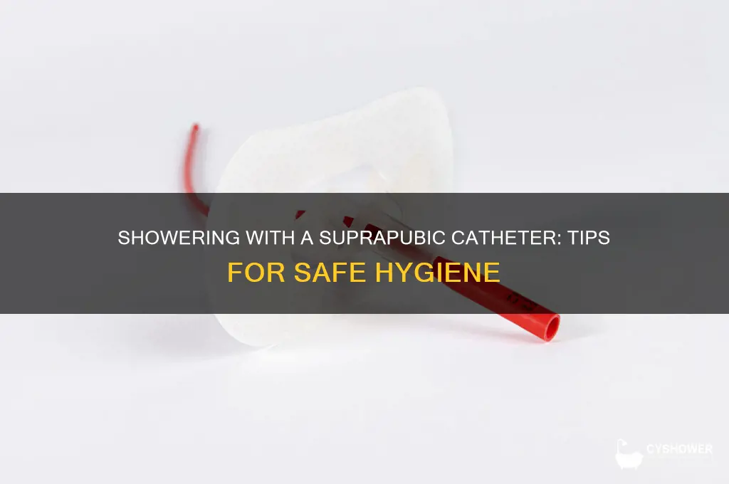 can you take a shower with a suprapubic catheter