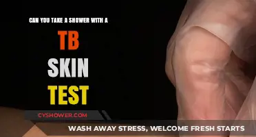 Showering After a TB Skin Test: What You Need to Know