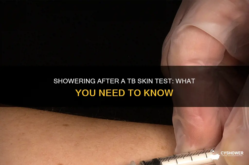 can you take a shower with a tb skin test