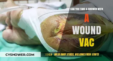 Showering with a Wound Vac: Safe Practices and Essential Tips