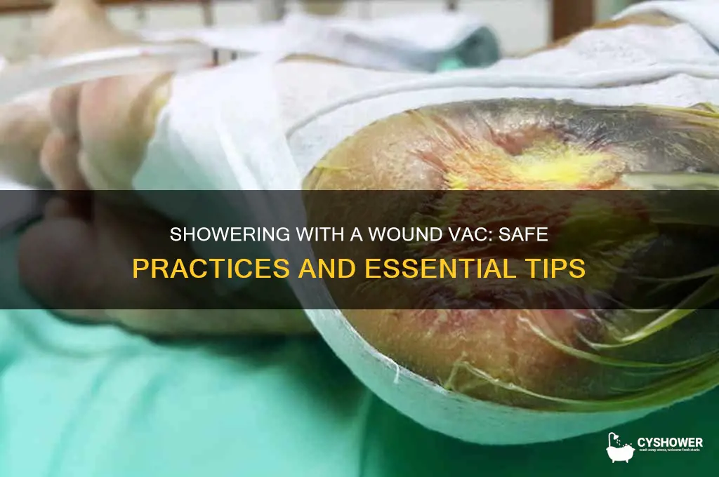 can you take a shower with a wound vac