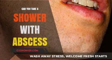 Showering with an Abscess: Safe Practices and Precautions to Follow
