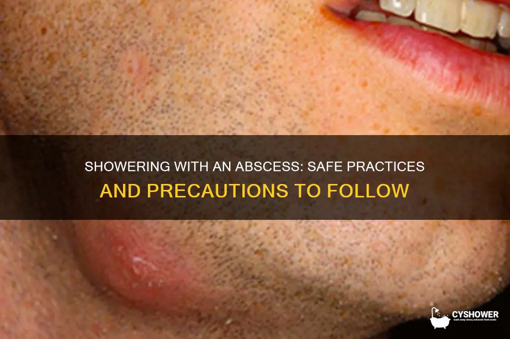 can you take a shower with abscess