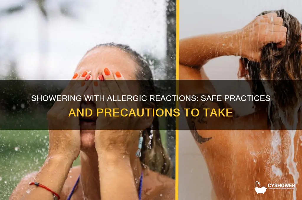 can you take a shower with an allergic reaction