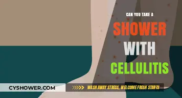 Showering with Cellulitis: Safe Practices and Precautions to Follow