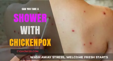 Showering with Chickenpox: Safe Practices and What You Need to Know