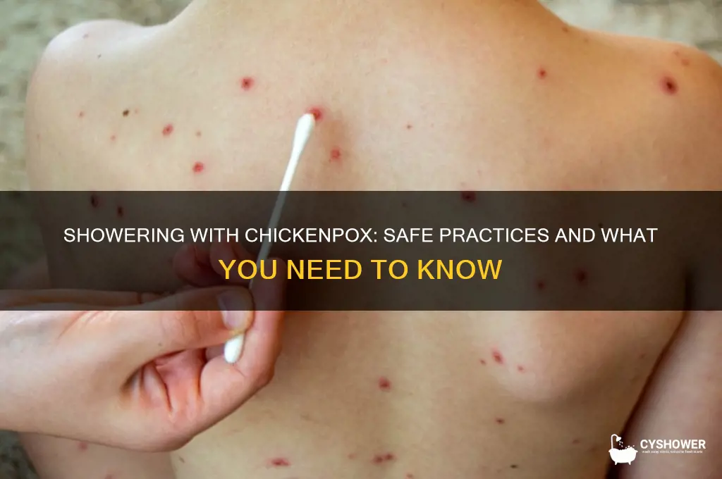 can you take a shower with chickenpox