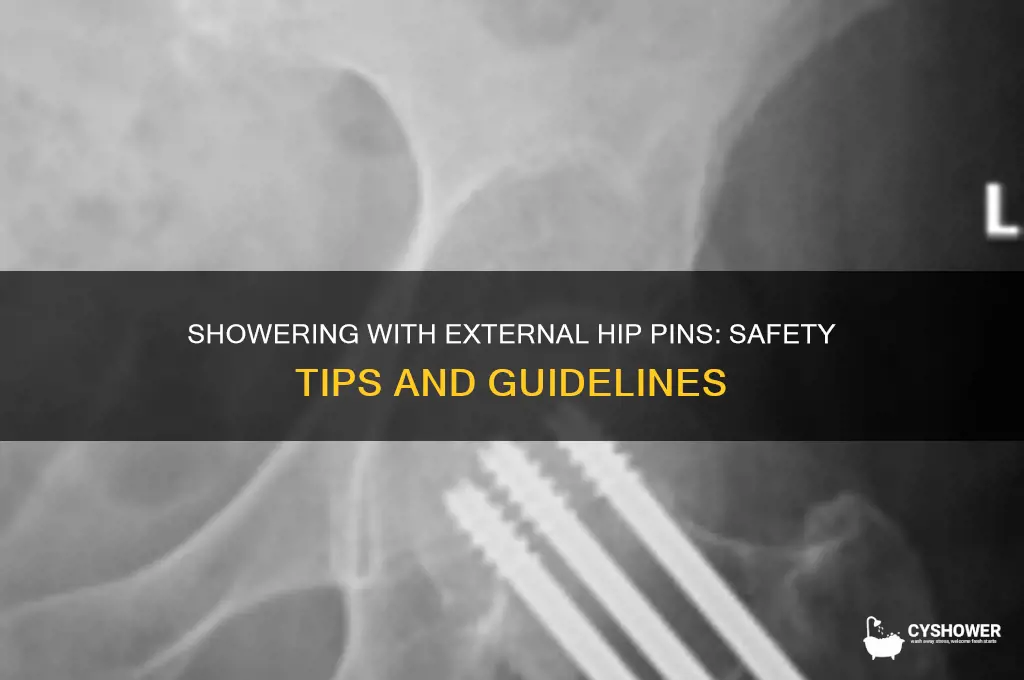 can you take a shower with external hip pins