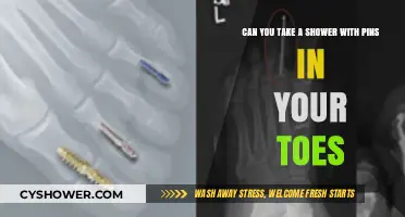 Showering with Toe Pins: Safe or Risky Practice?