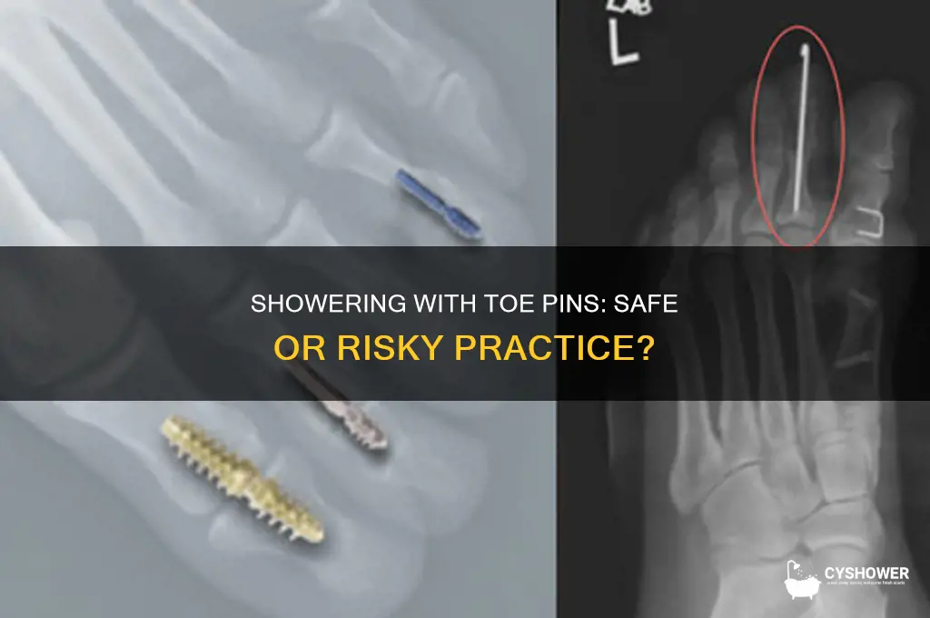 can you take a shower with pins in your toes