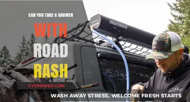 Showering with Road Rash: Safe Practices and Healing Tips