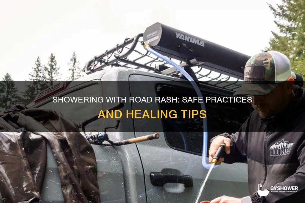 can you take a shower with road rash