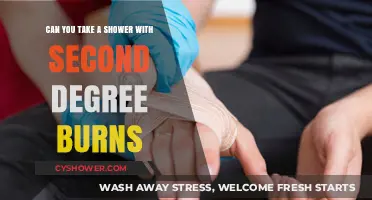 Showering with Second-Degree Burns: Safe Practices and Healing Tips