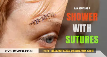 Showering with Sutures: Safe Practices and Post-Surgery Care Tips