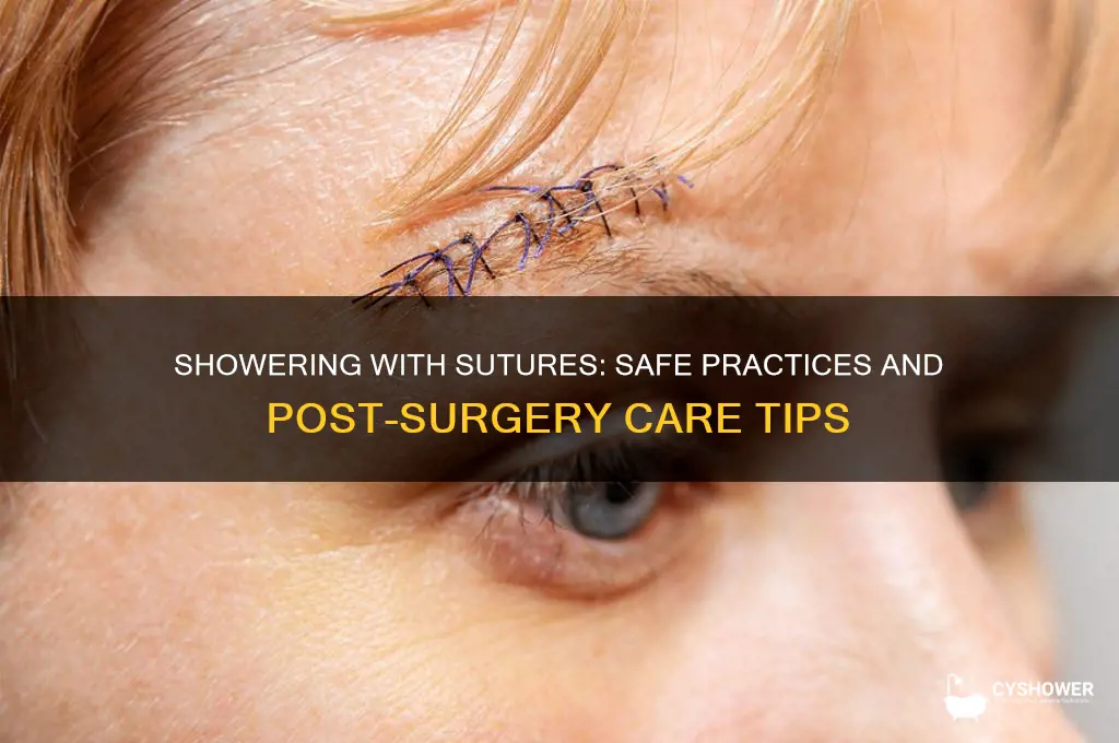 can you take a shower with sutures