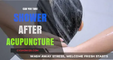 Shower After Acupuncture: Safe Practice or Risky Move?