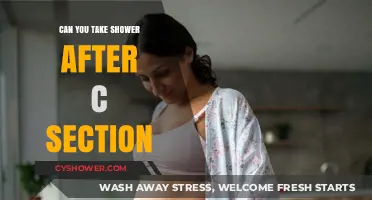Post-C-Section Shower Guide: When and How to Safely Cleanse