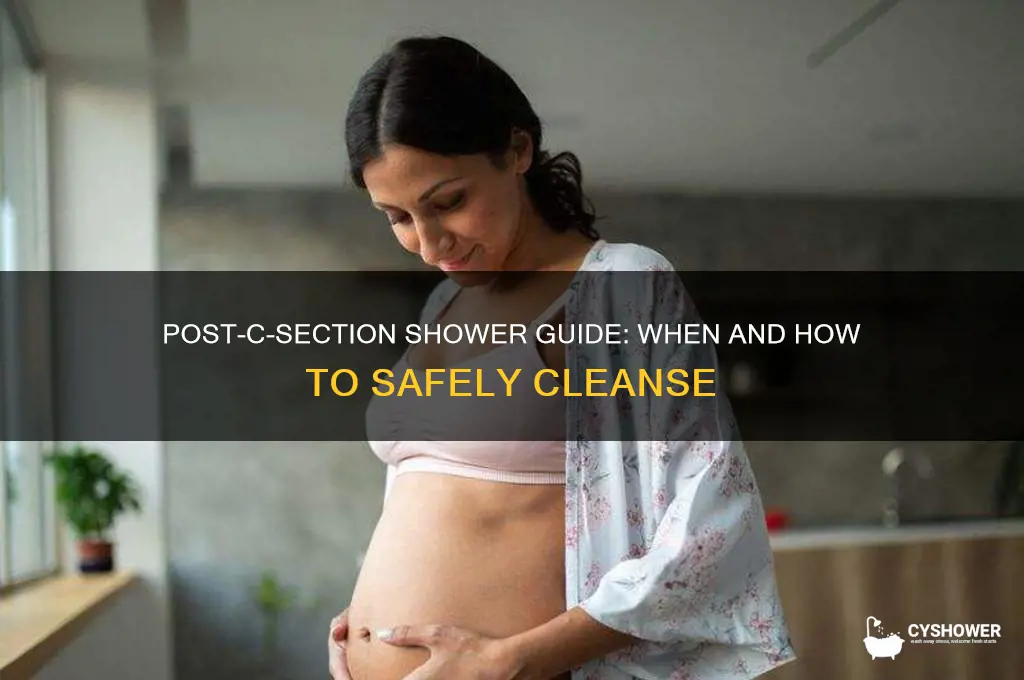 can you take shower after c section