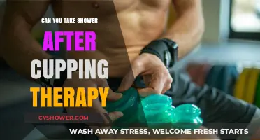 Shower After Cupping Therapy: Safe or Should You Wait?
